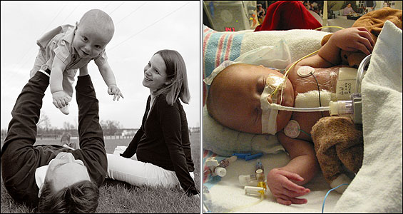 The Deffaas (left) - Brian, Jennifer, and 16-month-old William  near their new home in Michigan. About 10 days old, William Deffaa (right) lies in intensive care at Children's Hospital in Boston last year. Three months before he was born, doctors diagnosed him with what would have been a fatal heart defect and attempted to correct his condition with experimental surgery while he grew in his mother's womb.